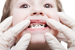 https://suranadentalclinic.com/wp-content/uploads/2021/12/tooth-Treatment-of-Pediatric-Patient.png