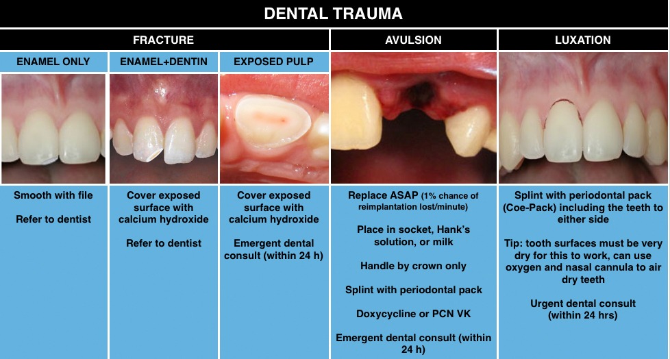 Tongue Injury From Teeth Treatment At Nancy Hansen Blog Tongue Injury From Teeth Treatment At Nancy Hansen Blog