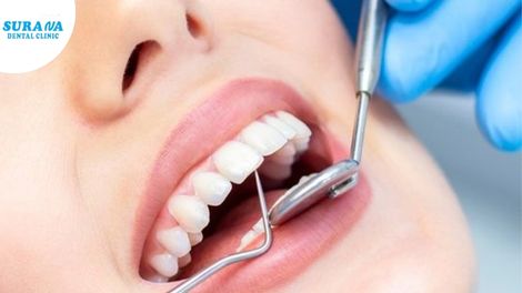 Best Dentist In Indore Near Me