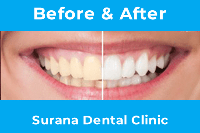 Home - Surana Dental Clinic