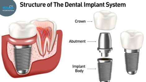 one of the best Indore Dental Clinic