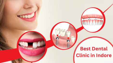 Best Dental Clinic in Indore