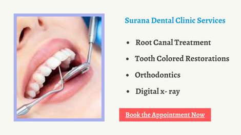 Surana Dental Clinic Services