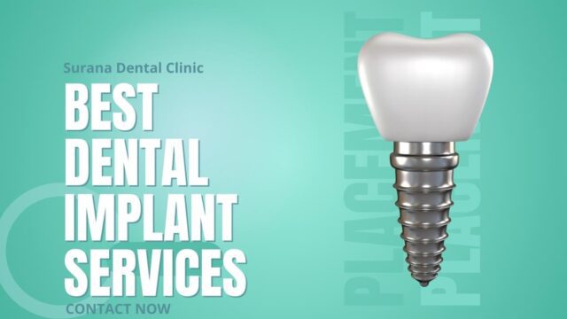 Cost Of One Implant In Indore