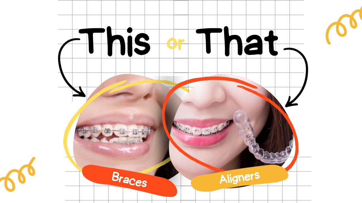 Braces or Aligners Which Should You Choose
