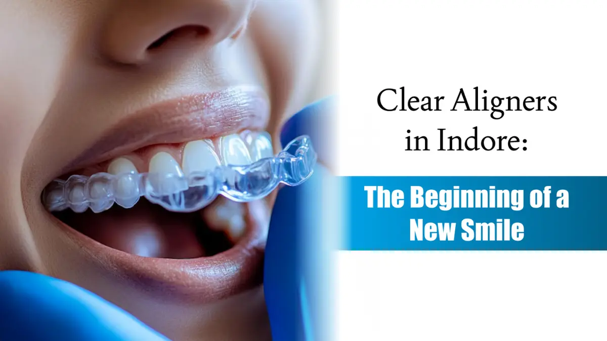 Clear Aligners in Indore: The Beginning of a New Smile