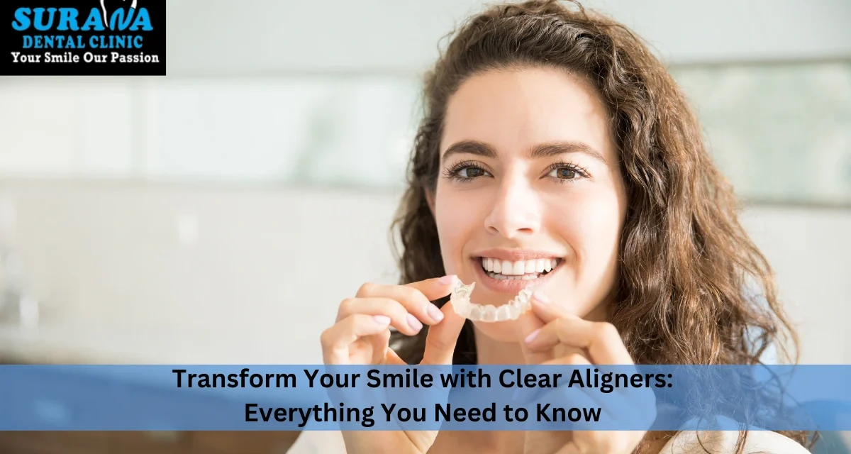 Transform Your Smile with Clear Aligners: Everything You Need to Know