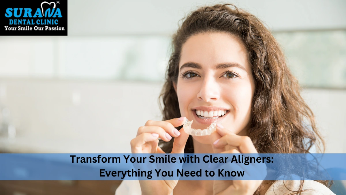 Aligners