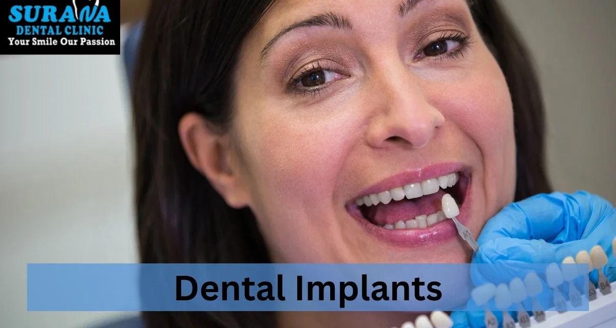 Top 5 Benefits of Dental Implants: Why They’re the Best Solution for Missing Teeth