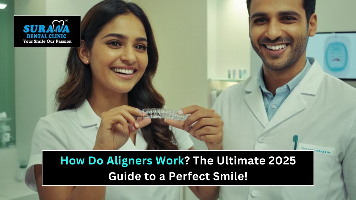 How Do Aligners Work The Ultimate 2025 Guide to a Perfect Smile! - Surana Dental Clinic