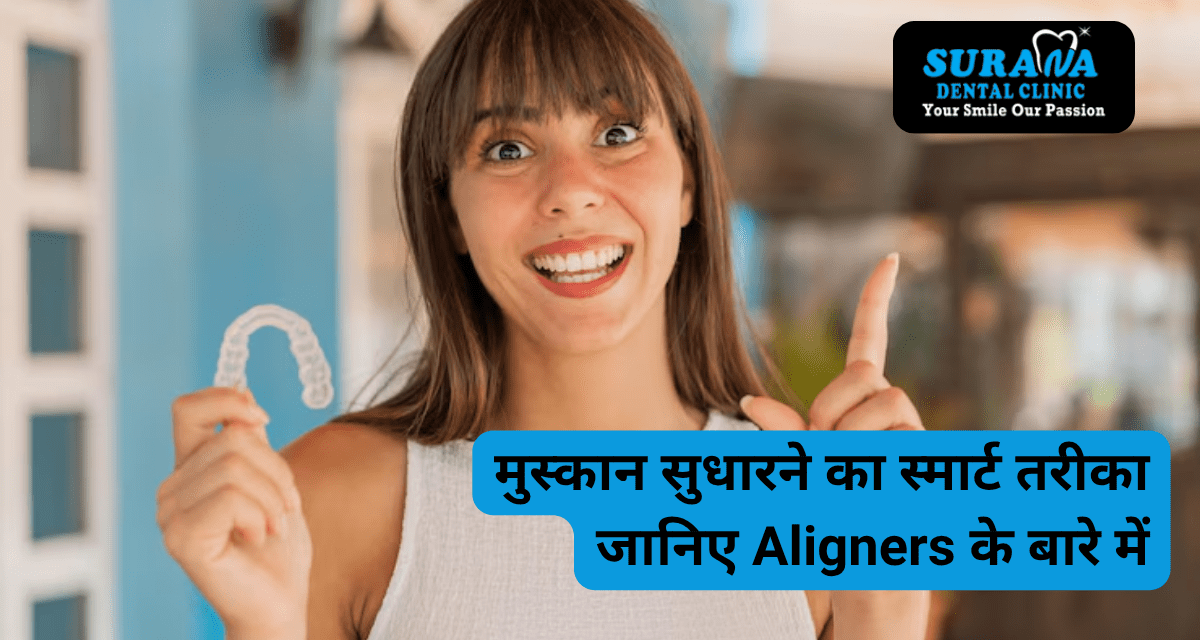 मुस्कान सुधारने का स्मार्ट तरीका – जानिए Aligners के बारे में