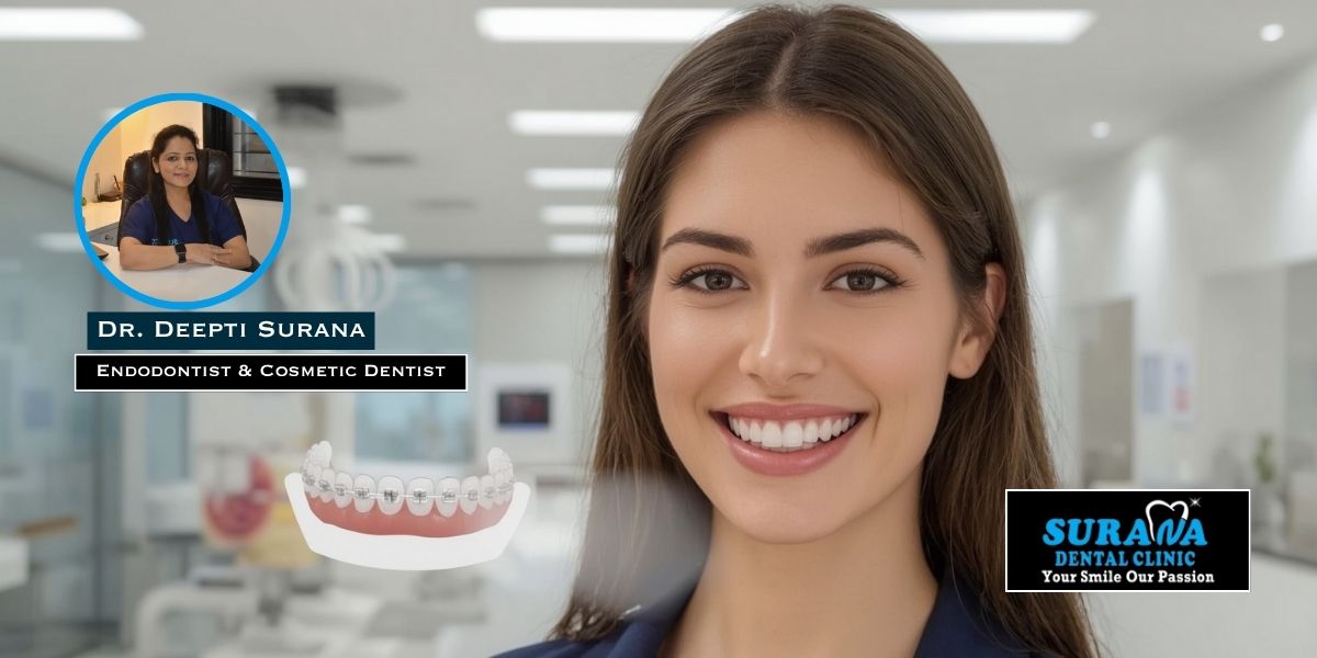 Invisible Braces Cost in Indore - Surana Dental Clinic in Indore