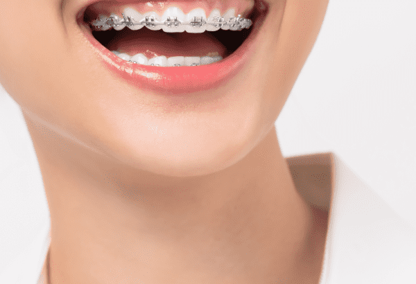Orthodontic