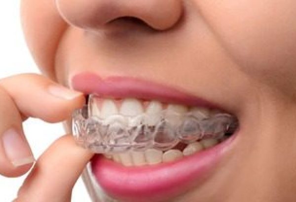 Invisaligners_59_11zon