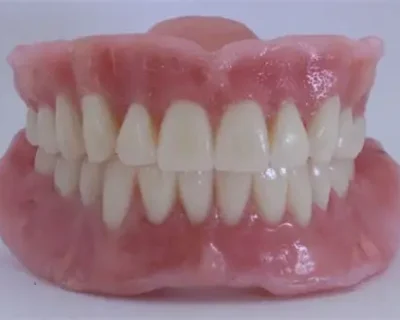 Removable Dentures