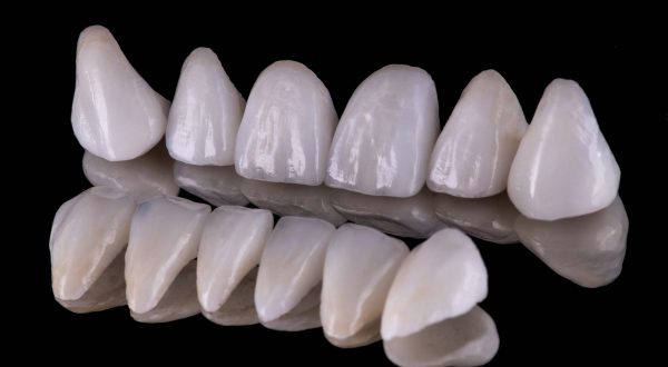 dentalcaps