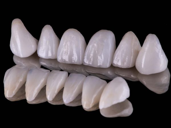 Aesthetic dental caps