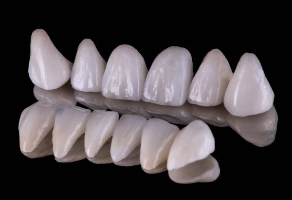 dentalcaps